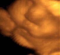 3D 4D Ultrasound service