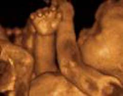 3D 4D Ultrasound service