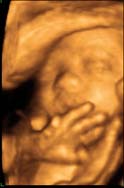 3D 4D Ultrasound service