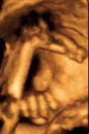 3D 4D Ultrasound service