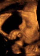 3D 4D Ultrasound service