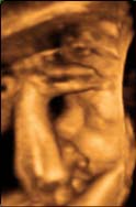 3D 4D Ultrasound service