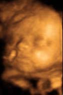 3D 4D Ultrasound service