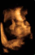 3D 4D Ultrasound service