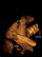 3D 4D Ultrasound service