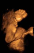 3D 4D Ultrasound service