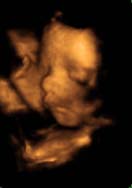 3D 4D Ultrasound service