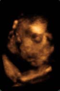 3D 4D Ultrasound service