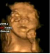 3D 4D Ultrasound service