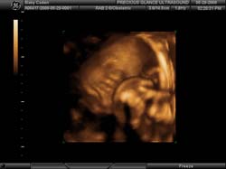 3D 4D Ultrasound service