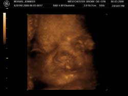 3D 4D Ultrasound service