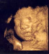 3D 4D Ultrasound service