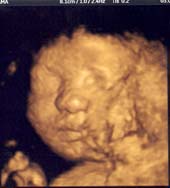 3D 4D Ultrasound service