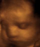 3D 4D Ultrasound service