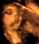 3D 4D Ultrasound service