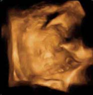 3D 4D Ultrasound service