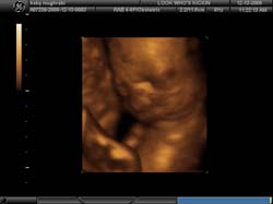 3D 4D Ultrasound service